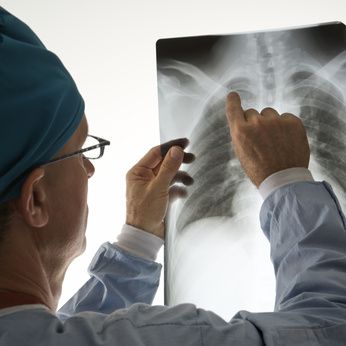 mellkasröntgenfelvétel