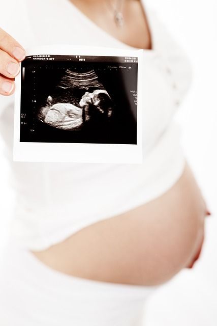 Schwangerschaft Ultraschallbild