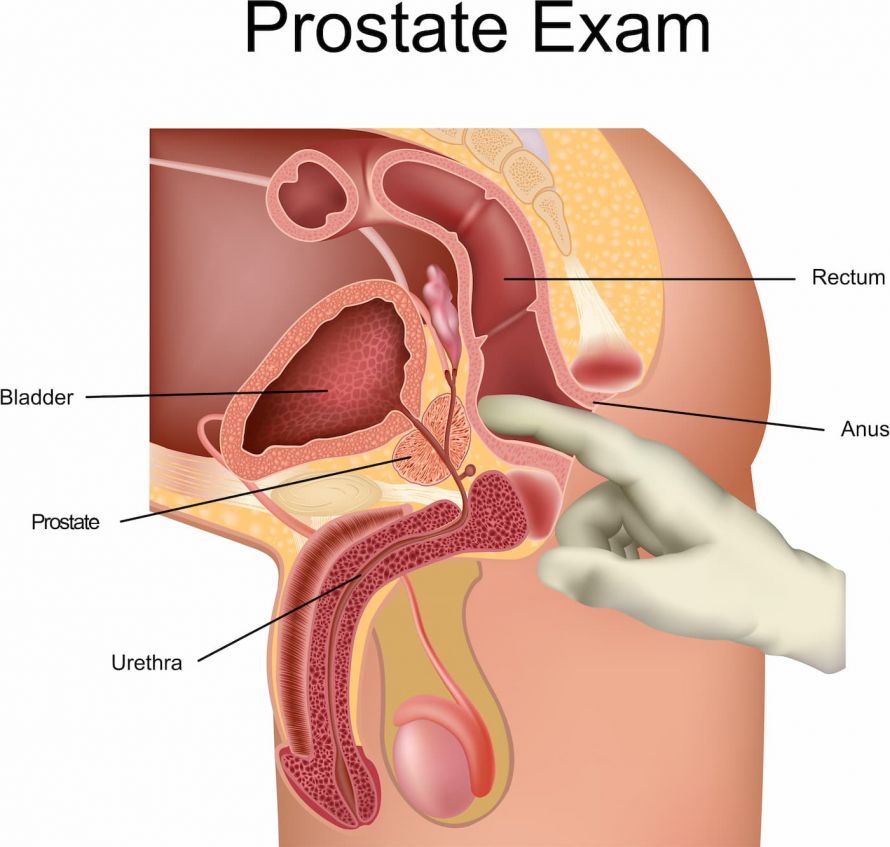 Prostatauntersuchung