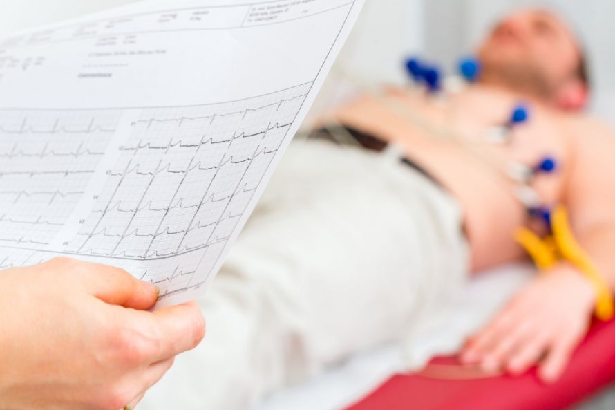 Arzt überprüft Herzrhythmus im EKG