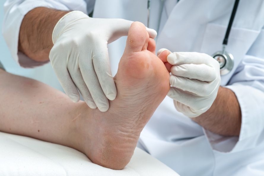 Untersuchung der Zehenzwischenräume bei der Fußpilz-Diagnose