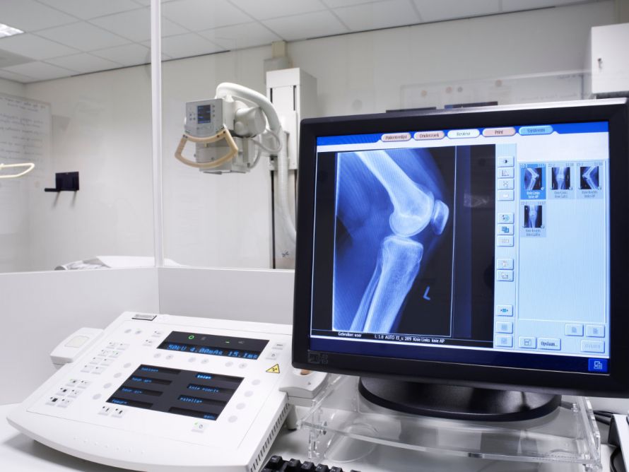 Knie im Röntgenbild