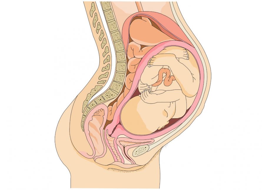 Ungeborenes Kind kurz vor der Geburt, Darstellung der Gebärmutter und anderer Organe der Mutter