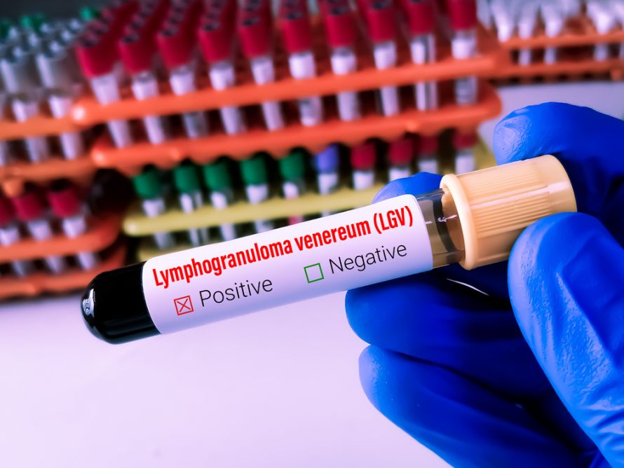 Blutuntersuchung mit Antikörpernachweis für  Lymphogranuloma venereum