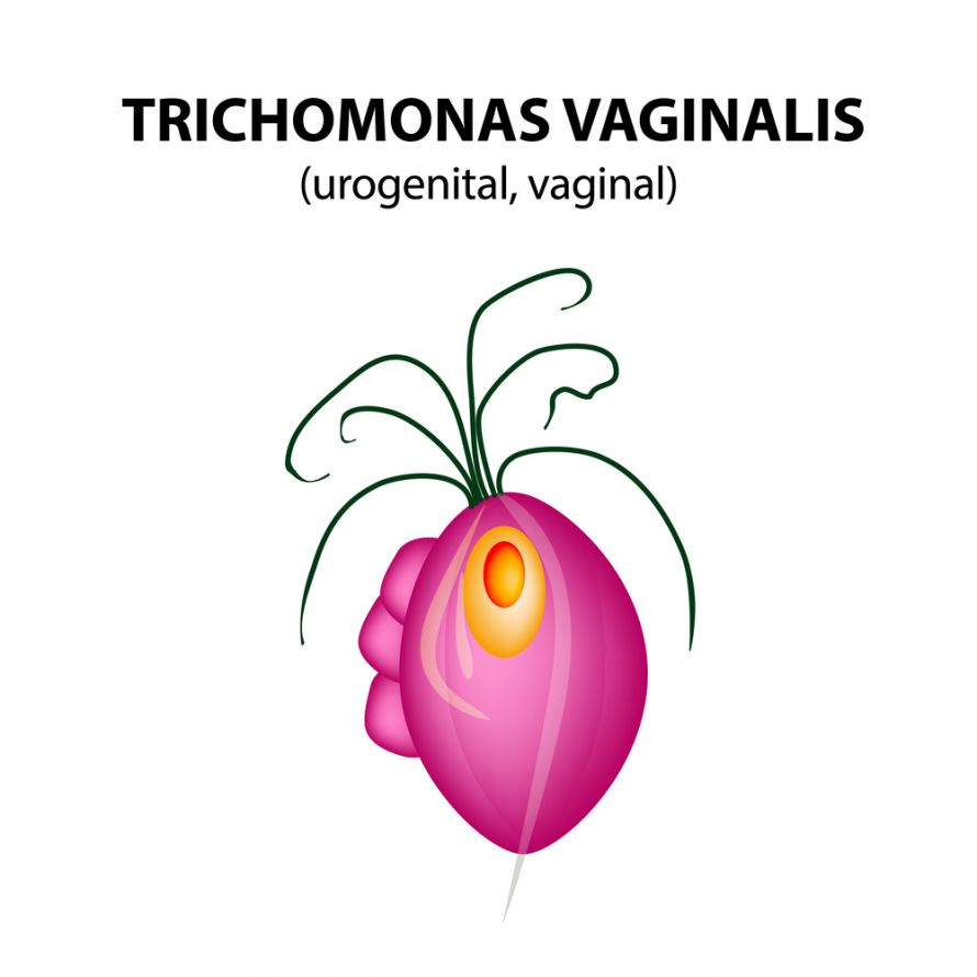 Trichomonaden